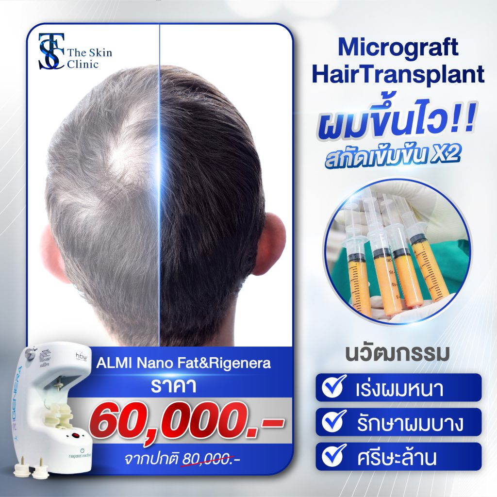 Artboard 6@2x-100