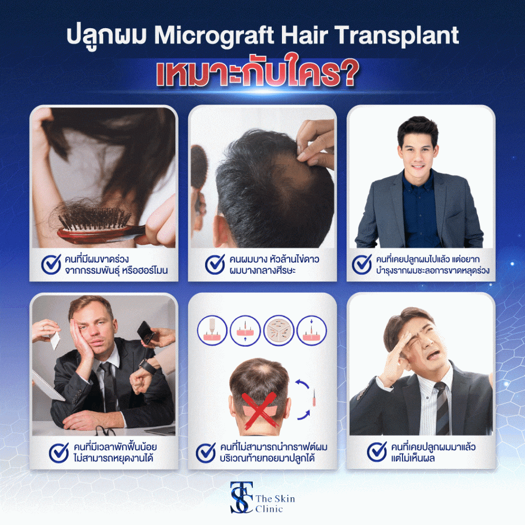 Hair Transplant Bangkok