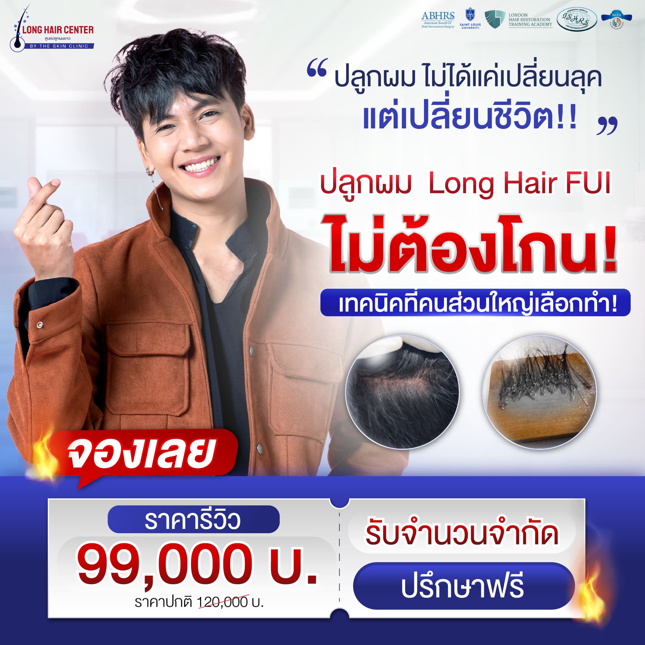 ปลูกผม Long hair FUI
